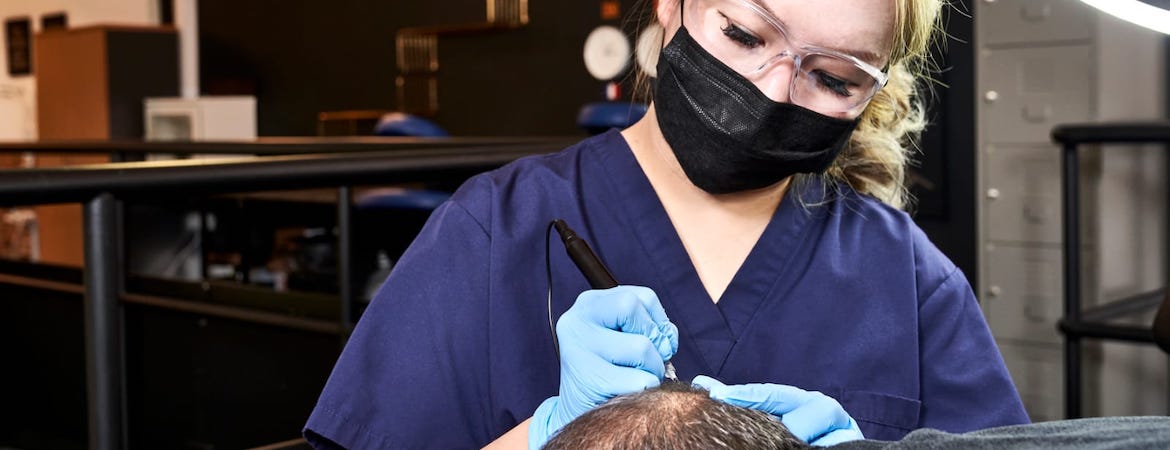 Ask the Hair Loss Expert: Is Scalp Micro Pigmentation the Next Best Solution to a Hair Transplant?