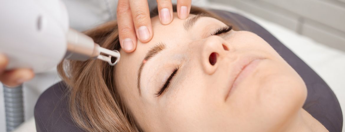 Best Places for Eyebrow Embroidery Removal in Singapore ugly eyebrows embroidery removal