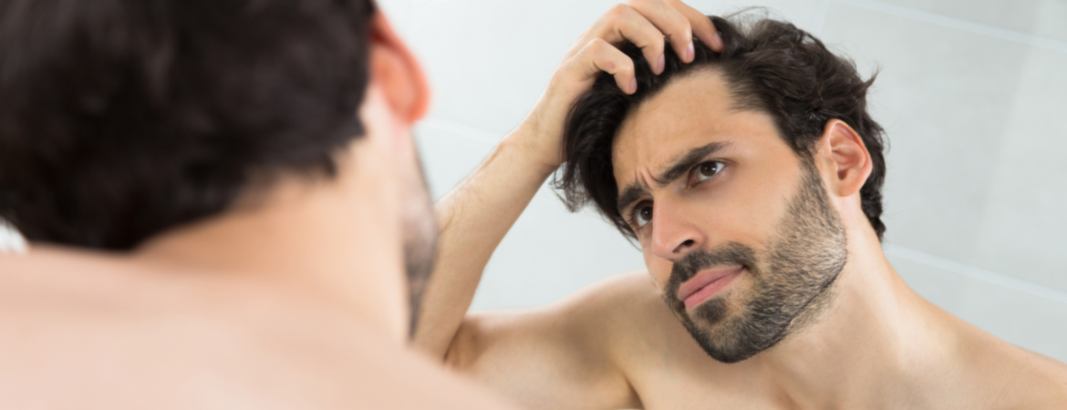 Top Hair Loss Solutions in Singapore for Men To Combat Balding, Thinning Hair, and Receding Hairlines