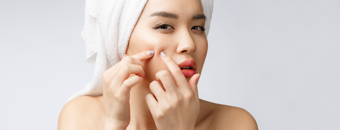 Top Skincare Products for Acne-Prone and Oily Skin in Singapore