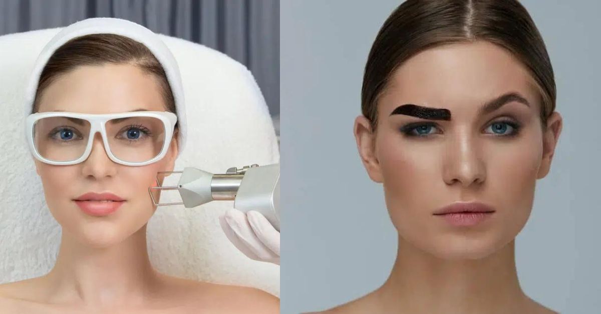 1Aesthetics, Medical & Surgery - Pico and CO2 Laser for Eyebrow Embroidery Removal
