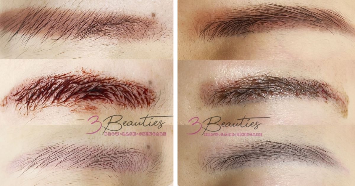 3Beauties - PhiRemoval and NanoPulse