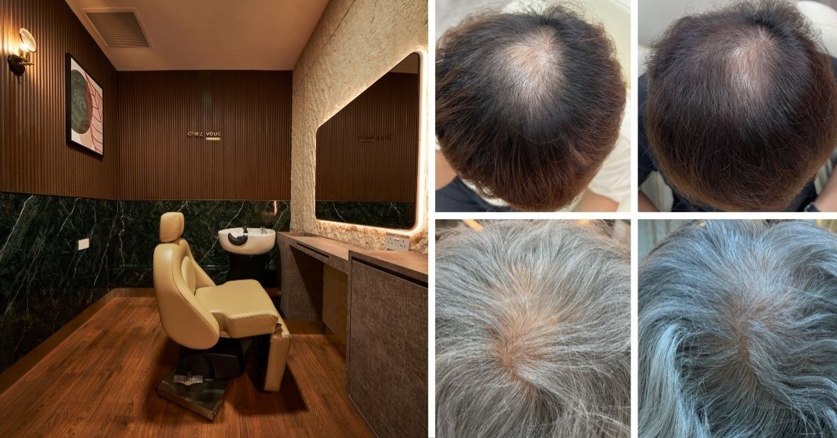 Chez Vous Hair Salon (Flagship): 8-Week Anti-Hairloss Exosomes Program