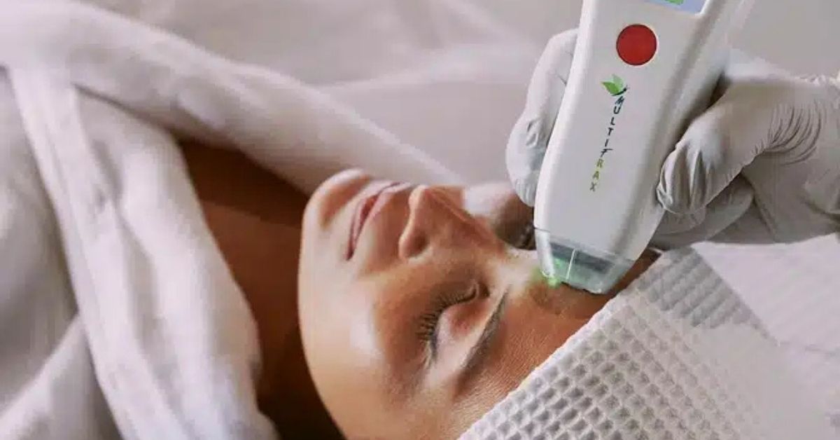 Digital Peel—what exactly is it, and how does it differ from standard laser treatments?
