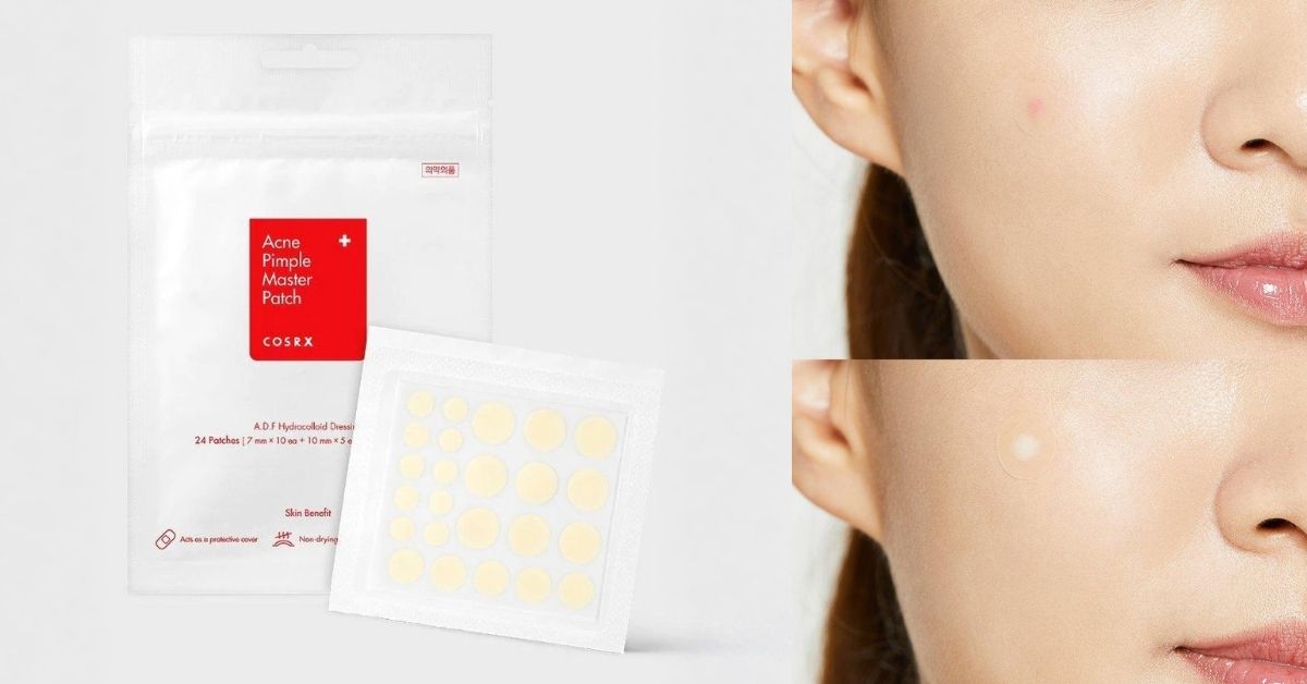 Hydrocolloid Patches – For The Pimple You Need To Stop Touching
