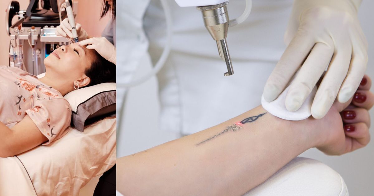 Kevin Chua Medical Aesthetic - Multiple Laser Options Based