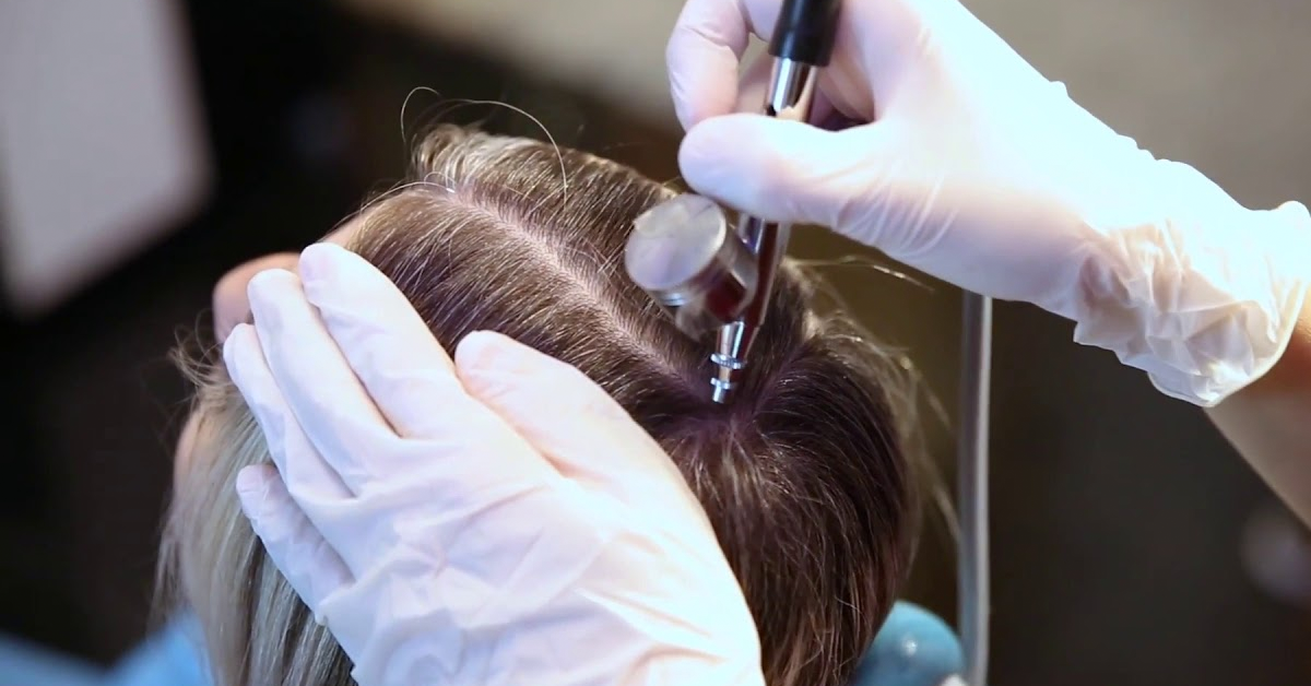 Best Hair Treatments For An Oily Scalp In Singapore 