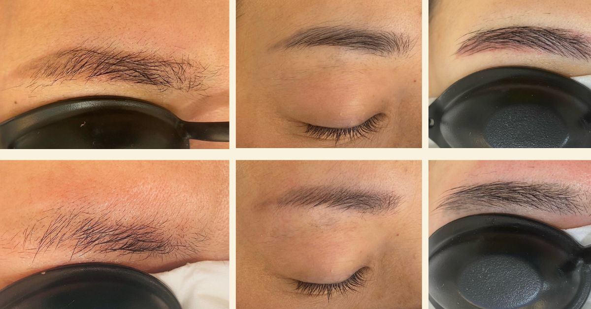 The Brow and Beauty Boutique - Less Invasive Non-Laser Removal
