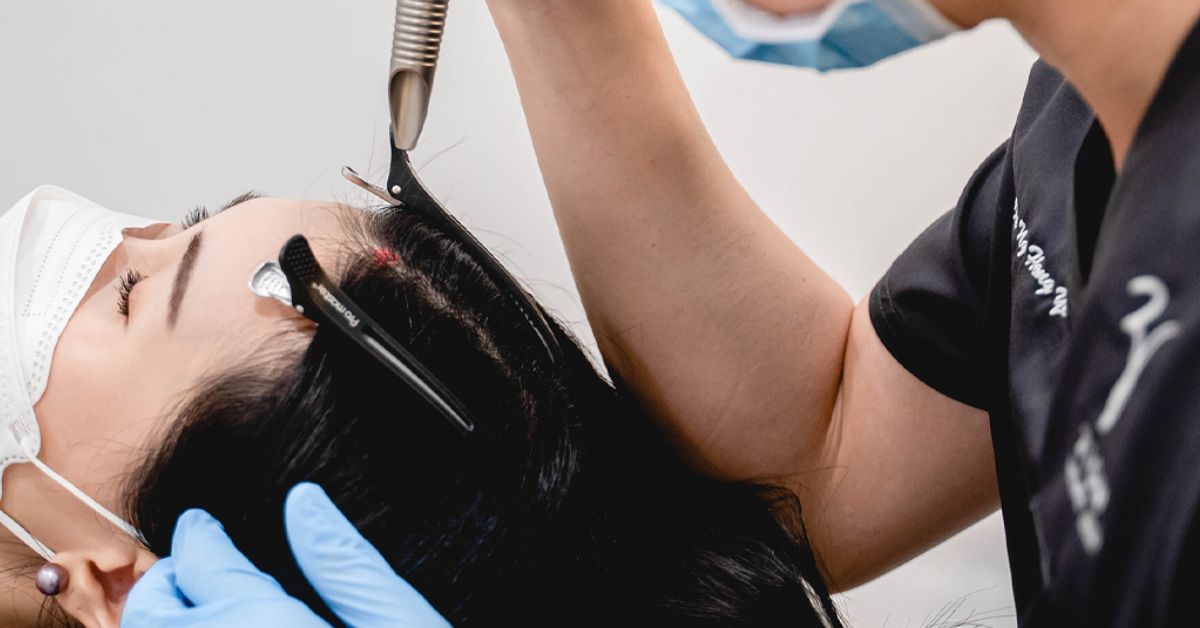 Zion Aesthetic Clinic - hair loss treatment