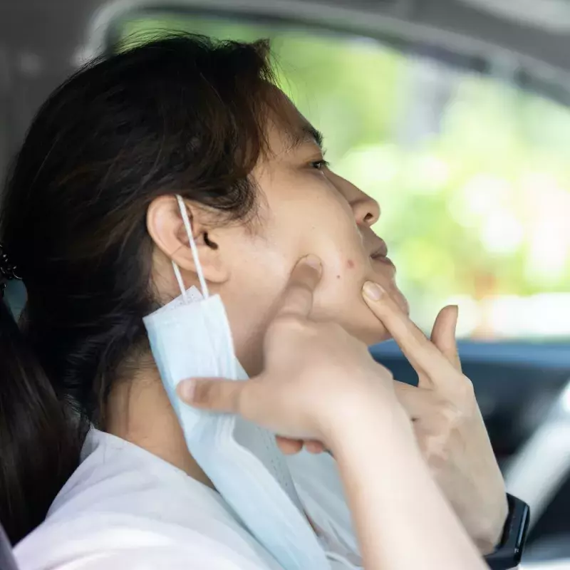 Say Goodbye to Acne: Skincare Solutions SG