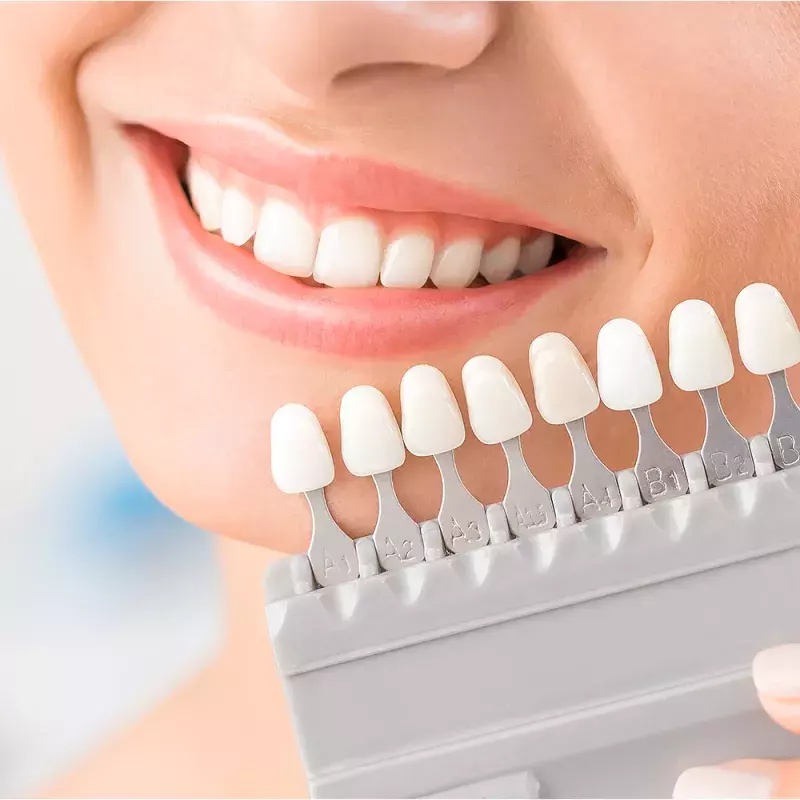 Dental Clinics in Singapore for Teeth Whitening - Banner